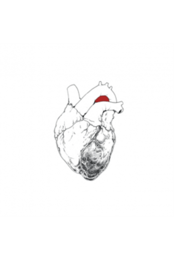 Swans - The Beggar LP - omot