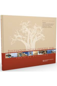 Postendodontska opskrba zubi /Vodič za kliničare